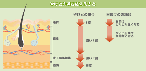 �₯�ǂ̐[���ɗႦ���