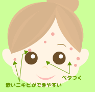 D�^�C�v�Ǐ�