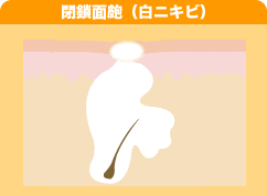 ����ᬁi���j�L�r�j