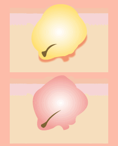 �u�]�E�^�v