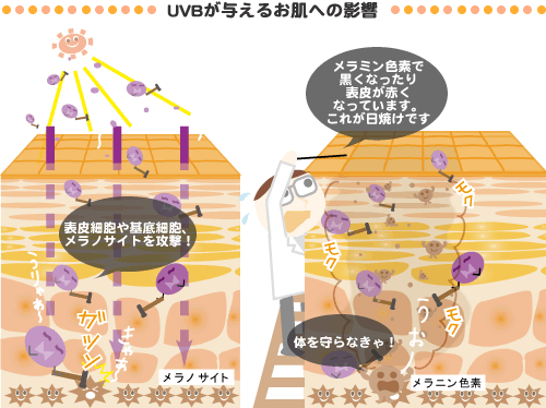 UVB���^���邨���ւ̉e��